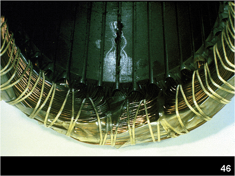 Figure 1 Compressor motor failure with suction reed lodged in stator.