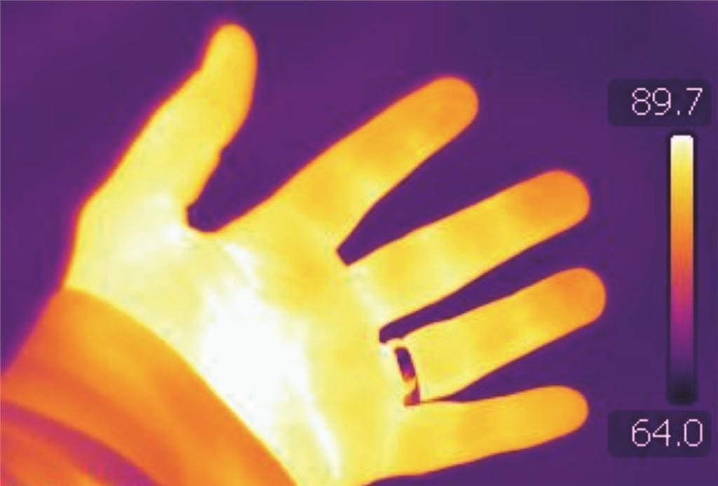 Figure 1 Infrared thermograph of thermally comfortable hand